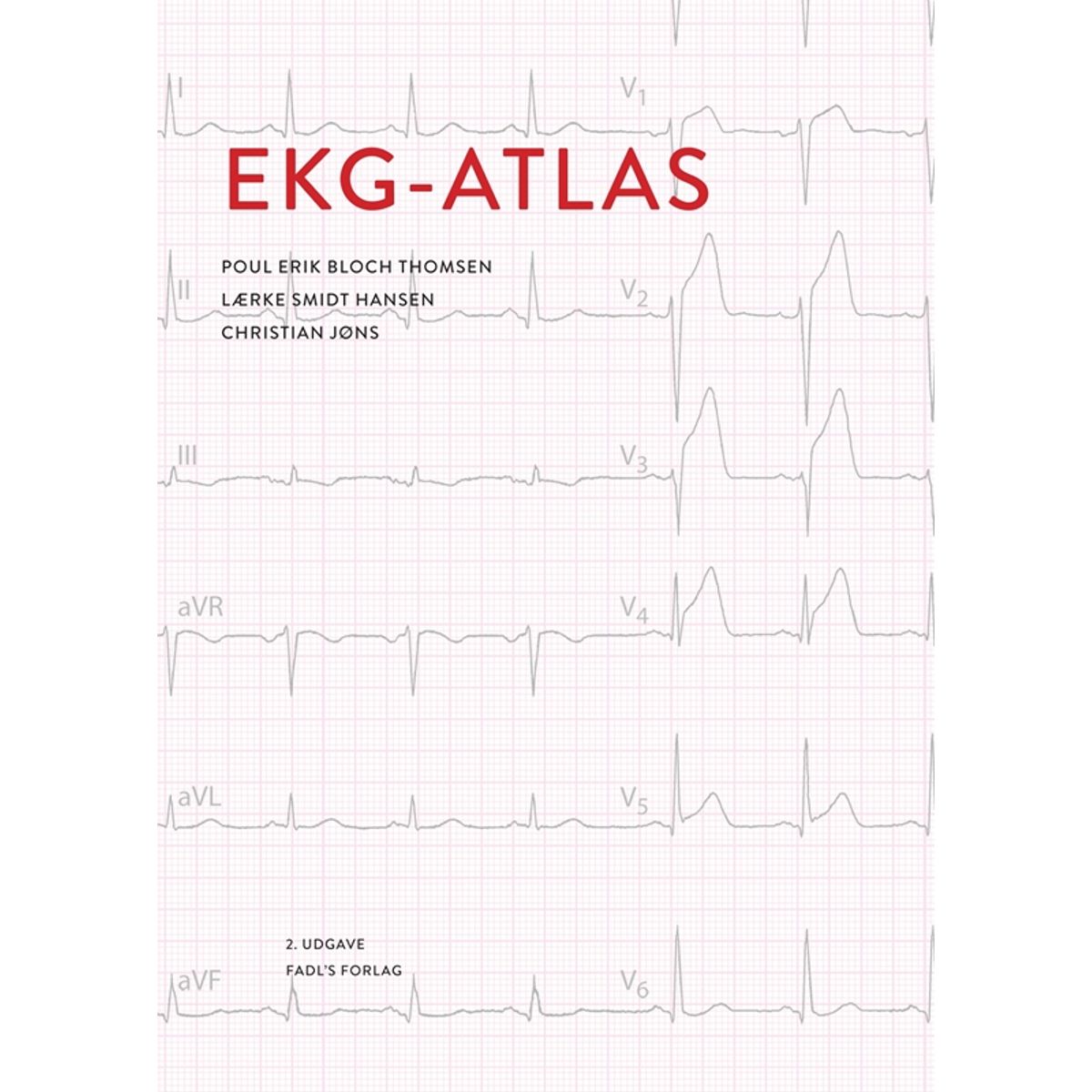 EKG-atlas